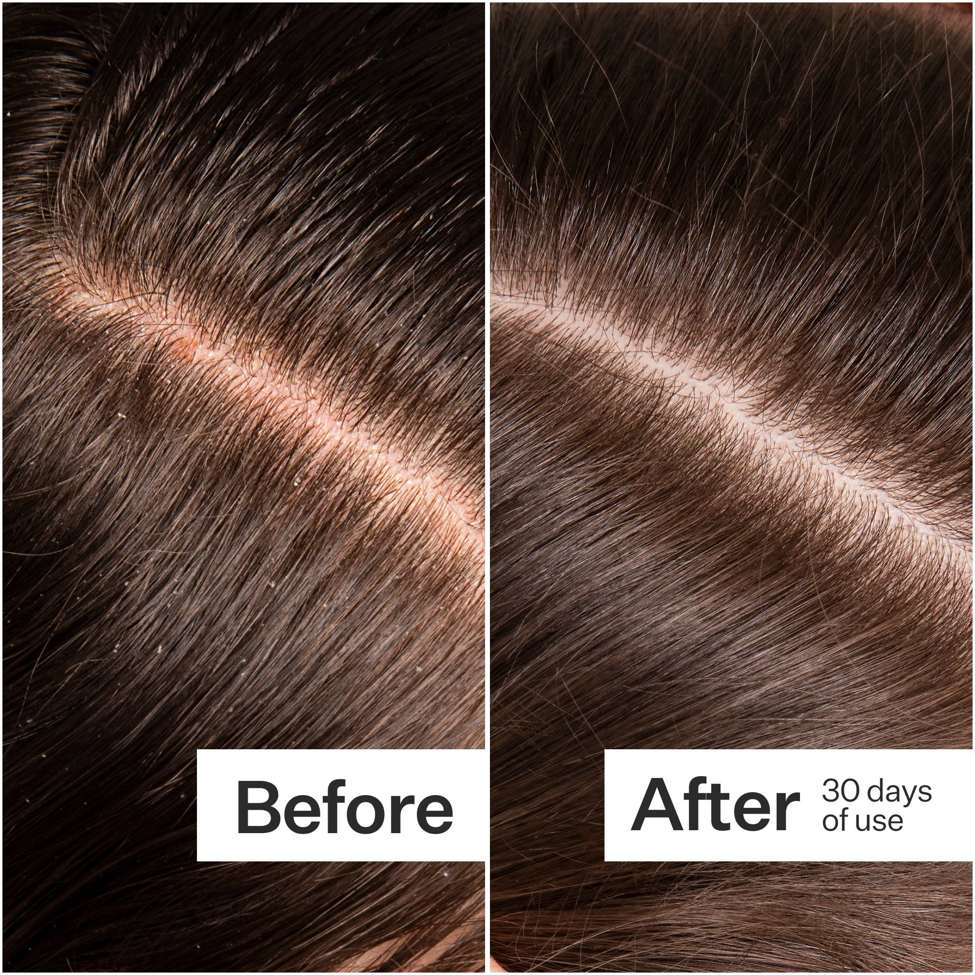 Microbiome Cooling Scalp Serum