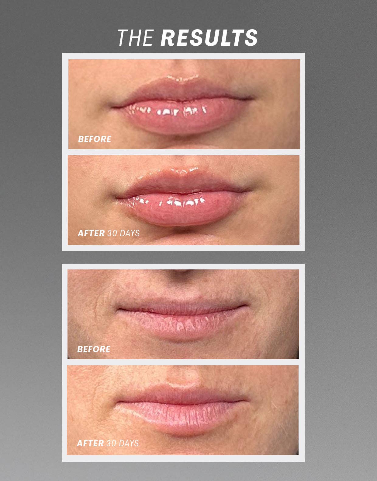 Lip Oasisᵀᴹ Glossy Treatment